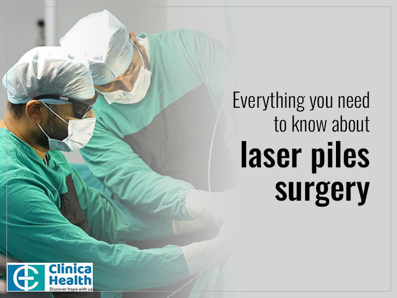 Everything you need to know about laser piles surgery AtoAllinks