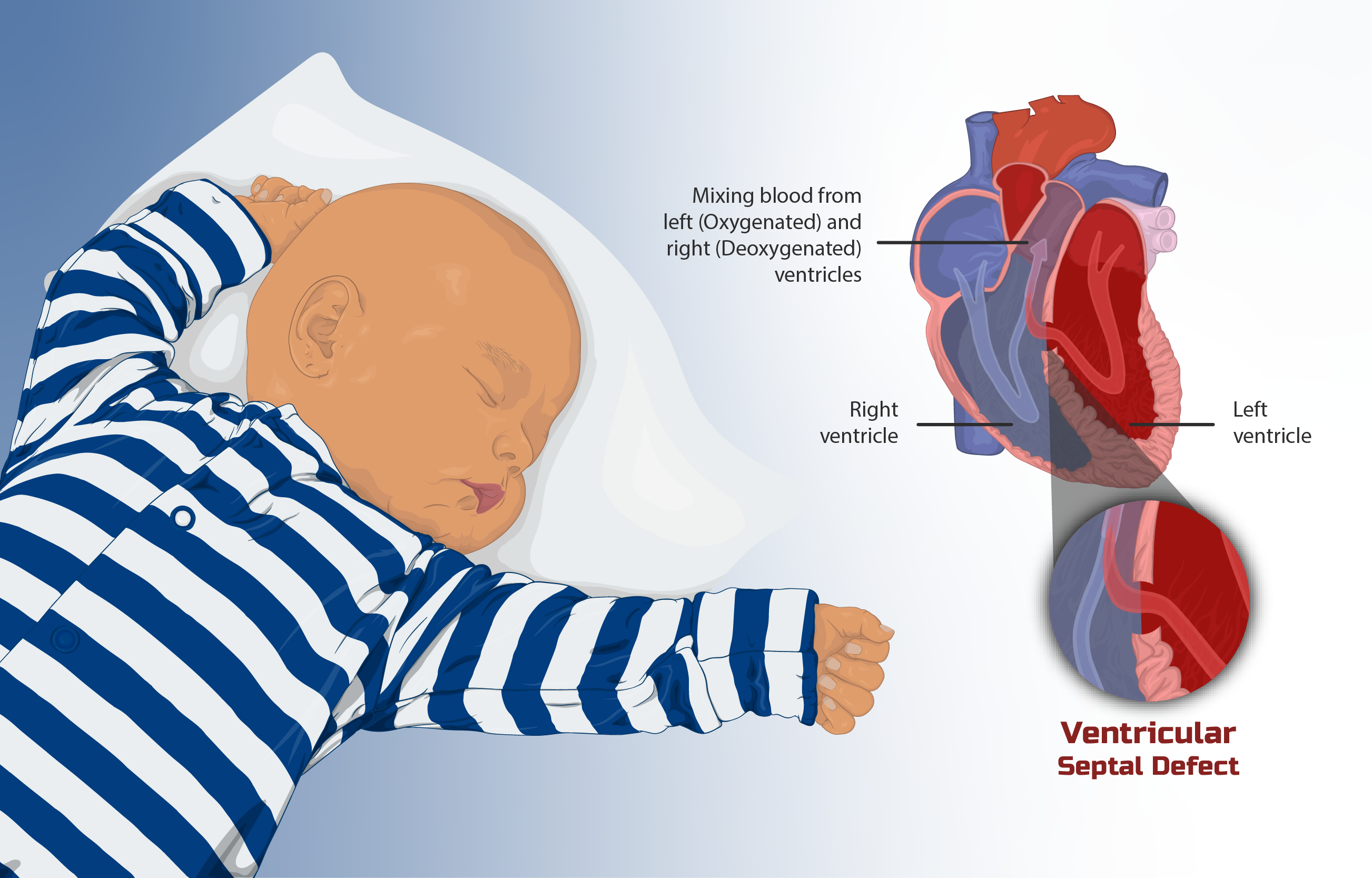 symptoms-and-treatment-for-heart-diseases-in-children-atoallinks