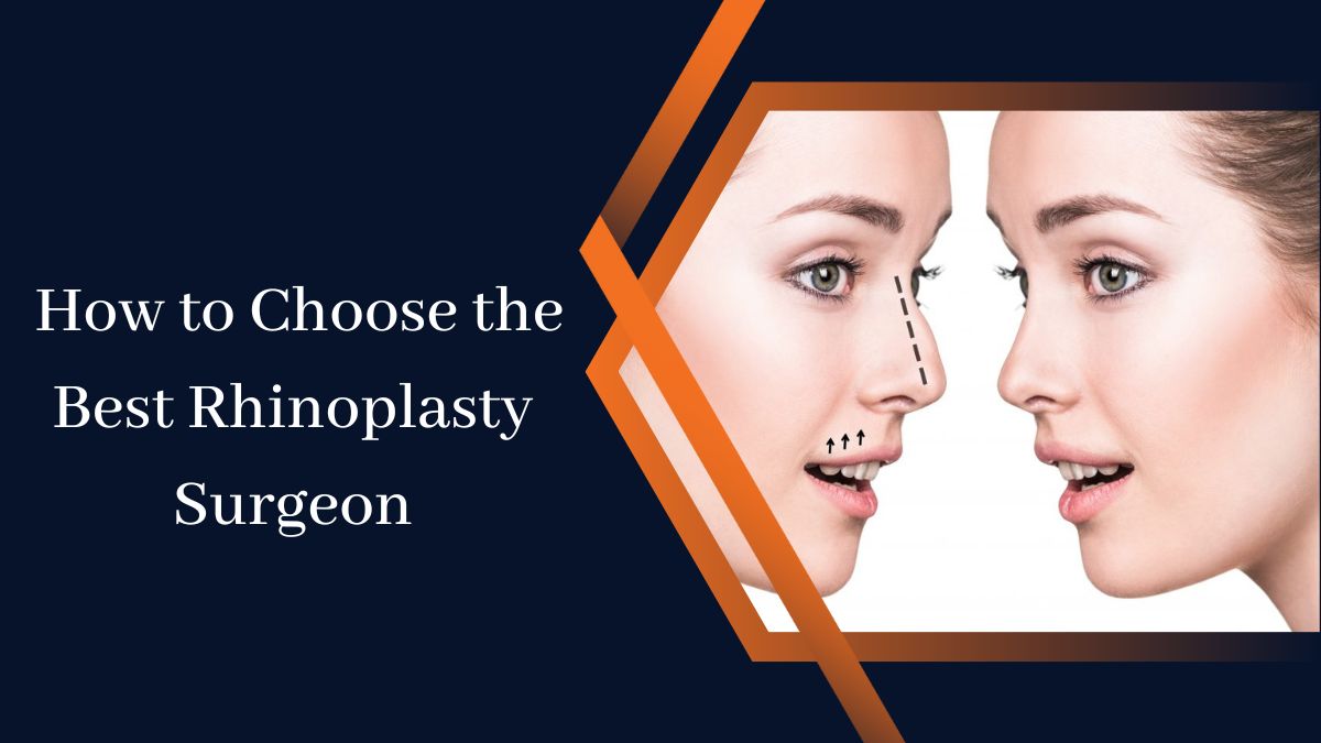 How To Choose The Best Rhinoplasty Surgeon Atoallinks 