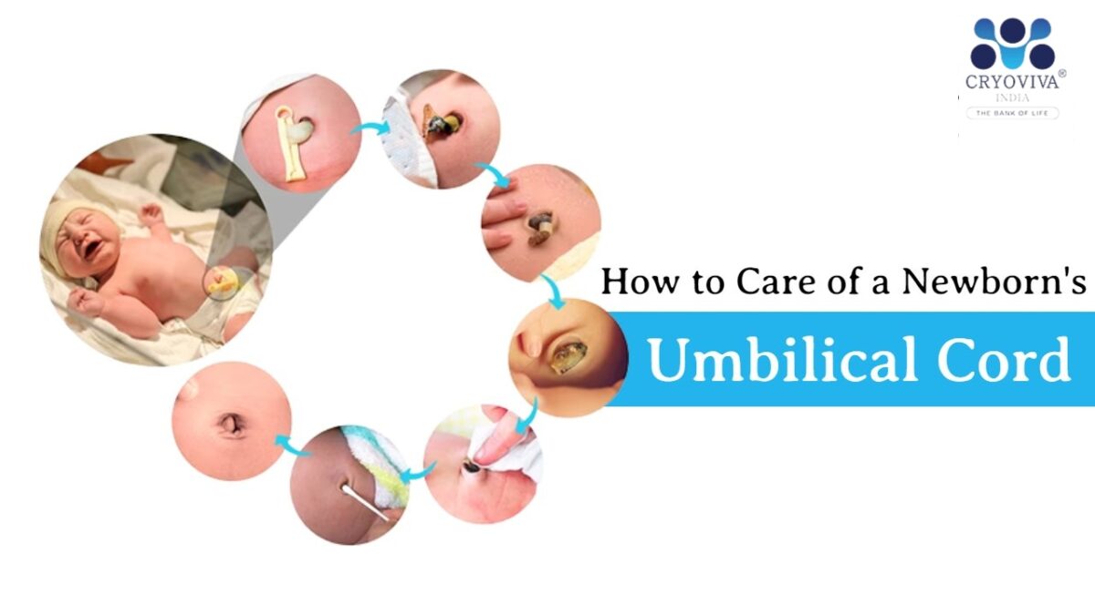 How to Care of a Newborn’s Umbilical Cord?