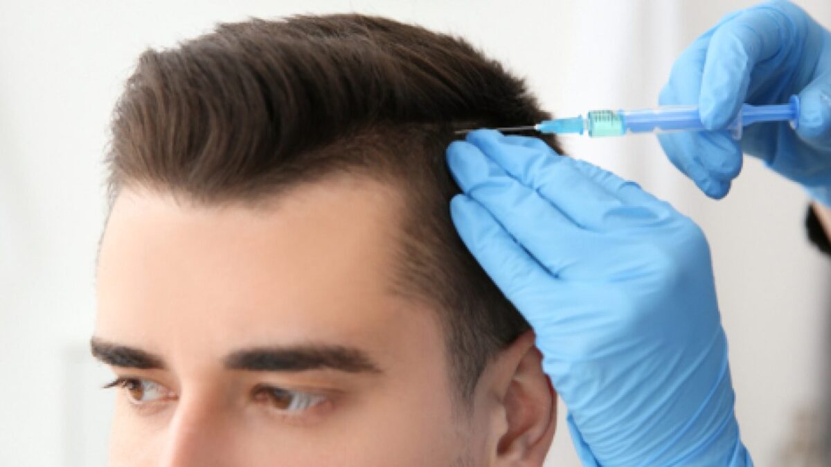 How To Choose The Best Hair Transplant Clinic in Chandigarh?