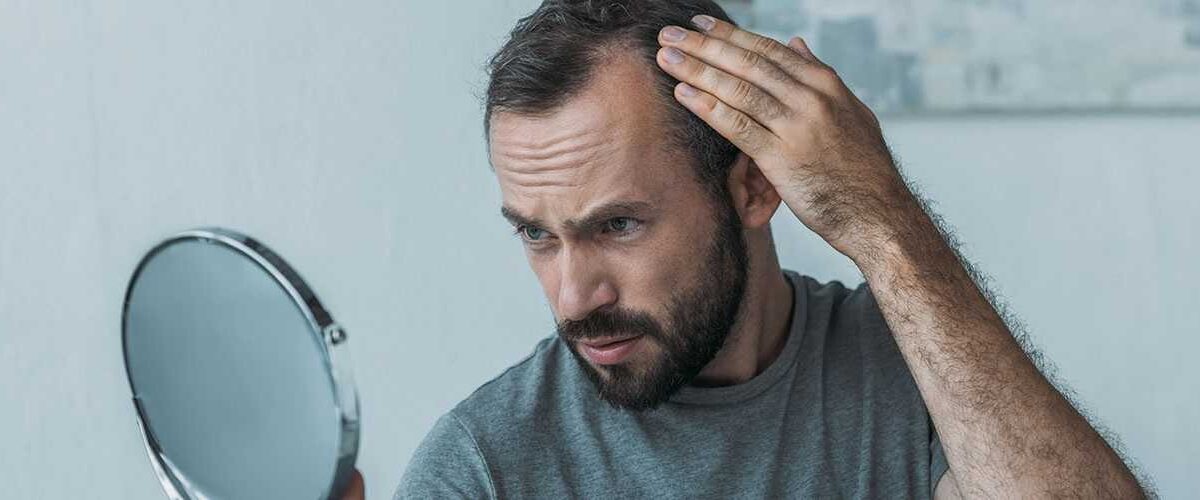 Is Hair Restoration The Best Solution For Genetic Baldness?