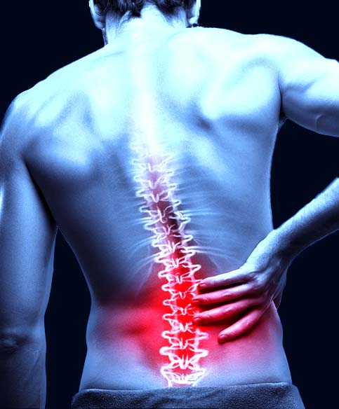 Stem Cell Therapy for Back Injuries
