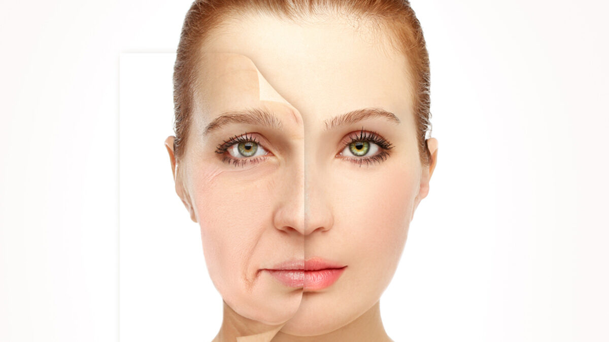 What is facelift Surgery? How is it performed?