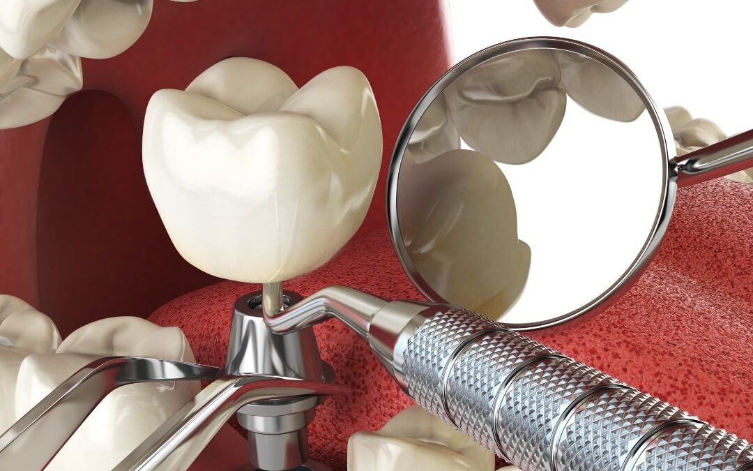 Mahimaa Dental Care: Your Trusted Dental Hospital in Coimbatore