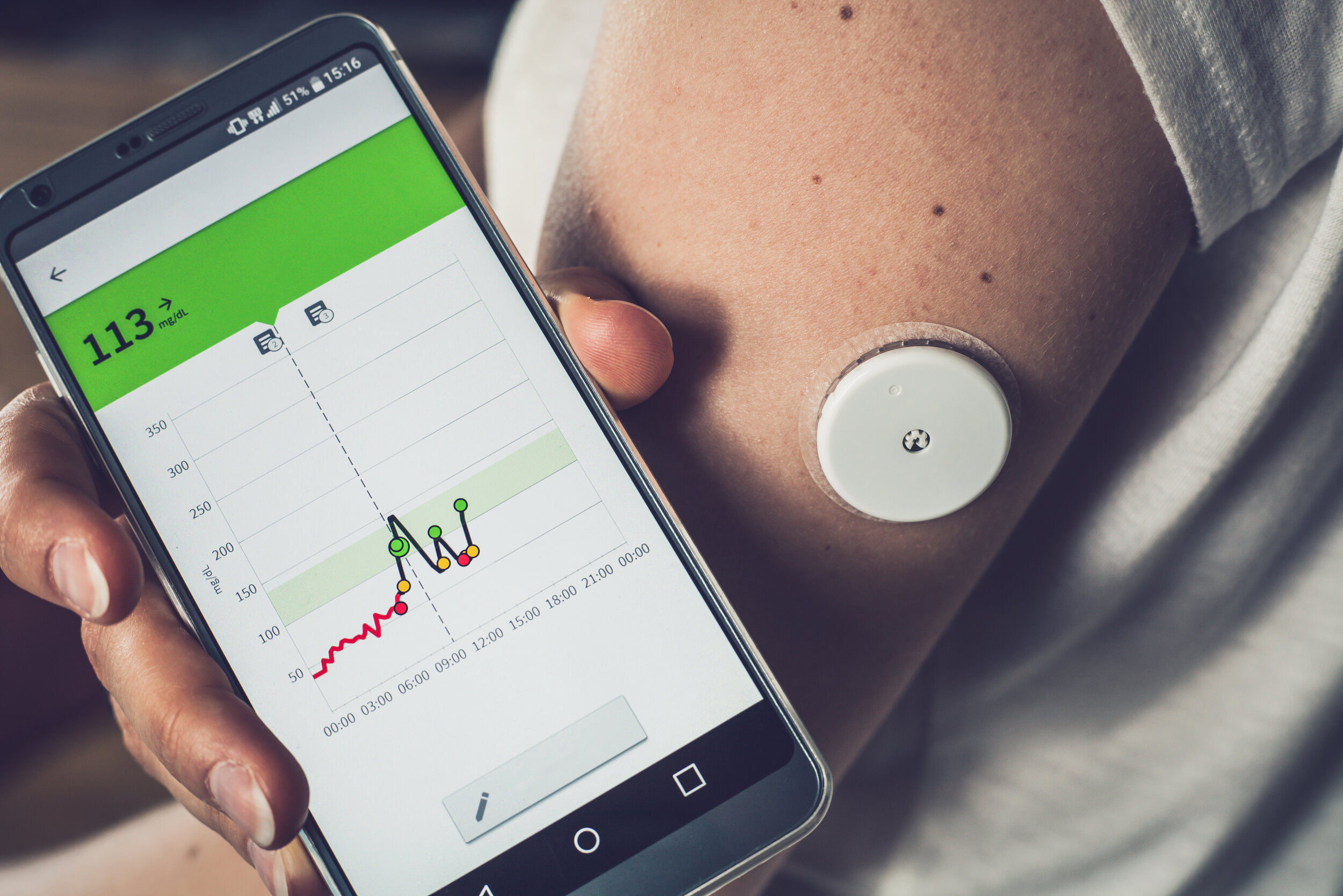 Continuous Glucose Monitor